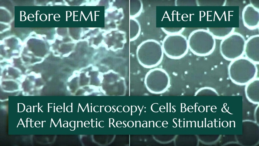Pulsed Electromagnetic Field PEMF Therapy Before and After Cells | Renewal Care Wellness | Beaverton, OR
